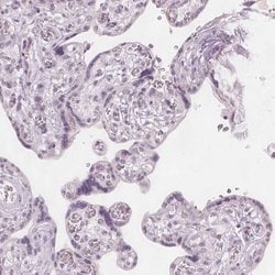 Invitrogen ERICH5 Polyclonal Antibody 100 &mu;L; Unconjugated:Antibodies,