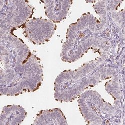 Invitrogen ERICH5 Polyclonal Antibody 100 &mu;L; Unconjugated:Antibodies,