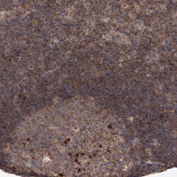 Invitrogen KIF21B Polyclonal Antibody 100 &mu;L | Buy Online | Invitrogen&trade; | Fisher Scientific