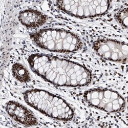 Invitrogen TESK2 Polyclonal Antibody 100 μL; Unconjugated:Antibodies,