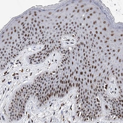 Invitrogen TESK2 Polyclonal Antibody 100 μL; Unconjugated:Antibodies,