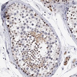 Invitrogen TESK2 Polyclonal Antibody 100 μL; Unconjugated:Antibodies,