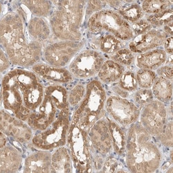 Invitrogen GNE Polyclonal Antibody 100 &mu;L; Unconjugated:Antibodies,