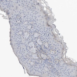 Invitrogen GNE Polyclonal Antibody 100 &mu;L; Unconjugated:Antibodies,