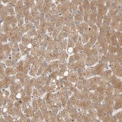 Invitrogen GNE Polyclonal Antibody 100 &mu;L; Unconjugated:Antibodies,
