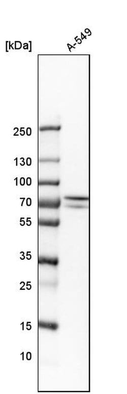 Invitrogen GNE Polyclonal Antibody 100 &mu;L; Unconjugated:Antibodies,