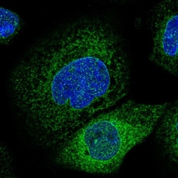 Invitrogen Lass2 Polyclonal Antibody 100 &mu;L; Unconjugated:Antibodies,