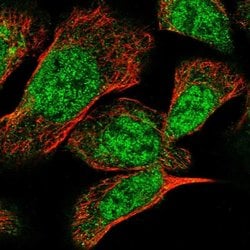 Invitrogen TSEN2 Polyclonal Antibody 100 &mu;L; Unconjugated:Antibodies,