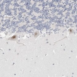 Invitrogen TSEN2 Polyclonal Antibody 100 &mu;L; Unconjugated:Antibodies,