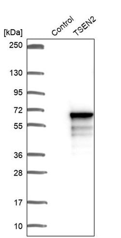 Invitrogen TSEN2 Polyclonal Antibody 100 &mu;L; Unconjugated:Antibodies,