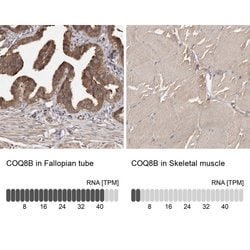 ADCK4 Polyclonal Antibody:Antibodies, Polyclonal