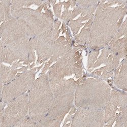 ADCK4 Polyclonal Antibody:Antibodies, Polyclonal