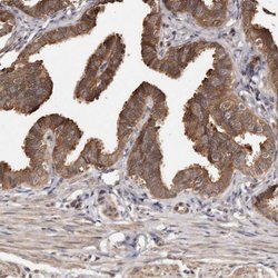 ADCK4 Polyclonal Antibody:Antibodies, Polyclonal