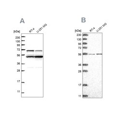 ADCK4 Polyclonal Antibody:Antibodies, Polyclonal