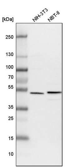 ADCK4 Polyclonal Antibody:Antibodies, Polyclonal