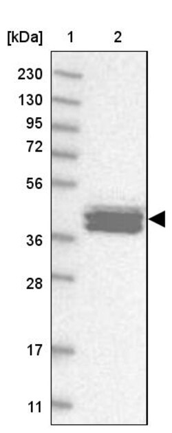 Invitrogen Calsequestrin 2 Polyclonal Antibody 100 &mu;L; Unconjugated:Antibodies,