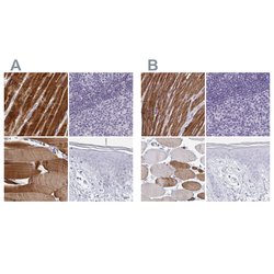 Invitrogen Calsequestrin 2 Polyclonal Antibody 100 &mu;L; Unconjugated:Antibodies,