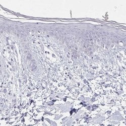 Invitrogen Calsequestrin 2 Polyclonal Antibody 100 &mu;L; Unconjugated:Antibodies,