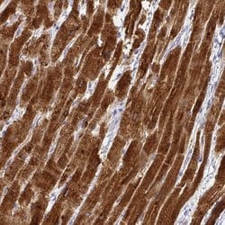 Invitrogen Calsequestrin 2 Polyclonal Antibody 100 &mu;L; Unconjugated:Antibodies,