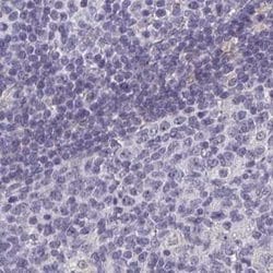 Invitrogen Calsequestrin 2 Polyclonal Antibody 100 &mu;L; Unconjugated:Antibodies,