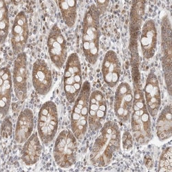 Invitrogen POLR3GL Polyclonal Antibody 100 &mu;L; Unconjugated:Antibodies,