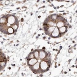 Invitrogen NUP43 Polyclonal Antibody 100 &mu;L; Unconjugated:Antibodies,