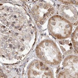 Invitrogen NUP43 Polyclonal Antibody 100 &mu;L; Unconjugated:Antibodies,