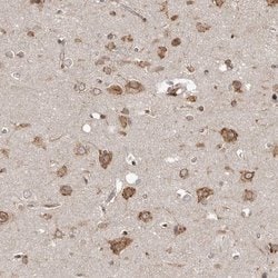 Invitrogen NUP43 Polyclonal Antibody 100 &mu;L; Unconjugated:Antibodies,
