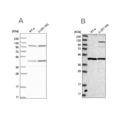 Invitrogen NUP43 Polyclonal Antibody 100 &mu;L; Unconjugated:Antibodies,