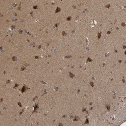 RAB3GAP2 Polyclonal Antibody:Antibodies, Polyclonal