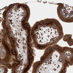 RAB3GAP2 Polyclonal Antibody:Antibodies, Polyclonal