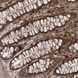 RAB3GAP2 Polyclonal Antibody:Antibodies, Polyclonal
