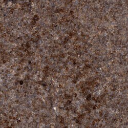 RAB3GAP2 Polyclonal Antibody:Antibodies, Polyclonal