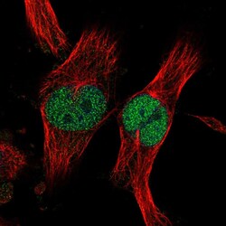 Invitrogen ZNF277 Polyclonal Antibody 100 μL; Unconjugated:Antibodies,