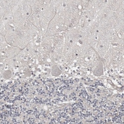 Invitrogen ZNF277 Polyclonal Antibody 100 μL; Unconjugated:Antibodies,