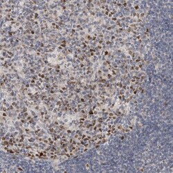 Invitrogen ZNF277 Polyclonal Antibody 100 μL; Unconjugated:Antibodies,