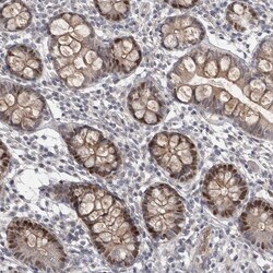 Invitrogen ZNF277 Polyclonal Antibody 100 μL; Unconjugated:Antibodies,