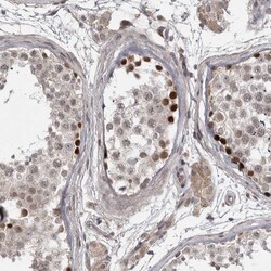 Invitrogen ZNF277 Polyclonal Antibody 100 μL; Unconjugated:Antibodies,