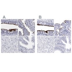 Invitrogen CCDC181 Polyclonal Antibody 100 &mu;L | Buy Online | Invitrogen&trade; | Fisher Scientific