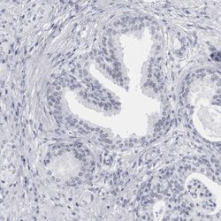 Invitrogen CCDC181 Polyclonal Antibody 100 &mu;L | Buy Online | Invitrogen&trade; | Fisher Scientific