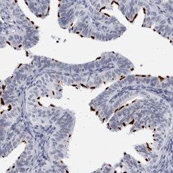 Invitrogen CCDC181 Polyclonal Antibody 100 &mu;L | Buy Online | Invitrogen&trade; | Fisher Scientific