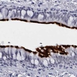 Invitrogen CCDC181 Polyclonal Antibody 100 &mu;L | Buy Online | Invitrogen&trade; | Fisher Scientific