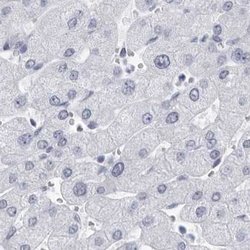 Invitrogen CCDC181 Polyclonal Antibody 100 &mu;L | Buy Online | Invitrogen&trade; | Fisher Scientific