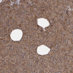 Invitrogen SCP2 Polyclonal Antibody 100 &mu;L; Unconjugated:Antibodies,