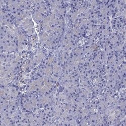 Invitrogen STAR Polyclonal Antibody 100 &mu;L | Buy Online | Invitrogen&trade; | Fisher Scientific