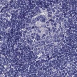 Invitrogen STAR Polyclonal Antibody 100 &mu;L | Buy Online | Invitrogen&trade; | Fisher Scientific
