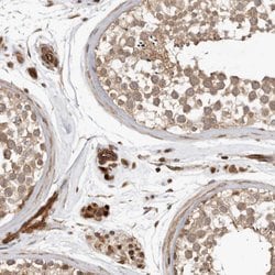 Invitrogen GPATCH2 Polyclonal Antibody 100 &mu;L; Unconjugated:Antibodies,