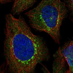 Invitrogen EVI5 Polyclonal Antibody 100 &mu;L; Unconjugated:Antibodies,