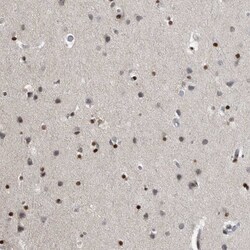 Invitrogen EVI5 Polyclonal Antibody 100 &mu;L; Unconjugated:Antibodies,