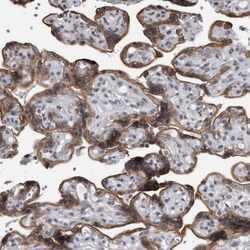 Invitrogen EVI5 Polyclonal Antibody 100 &mu;L; Unconjugated:Antibodies,